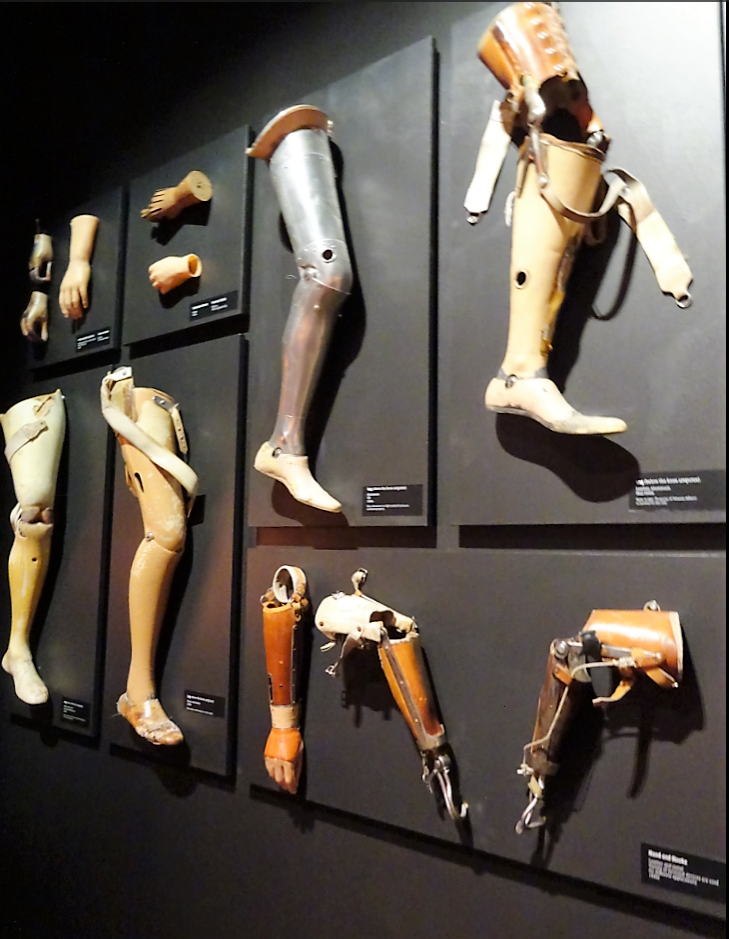 David Moe's vintage prosthetic collection. Eve Lazarus photo